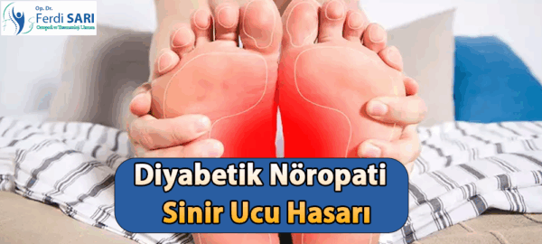Diyabetik nöropati sinir hasarı anatomik görseli